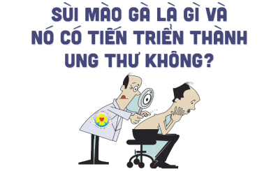 Sùi mào gà là gì và nó có tiến triển thành ung thư không?
